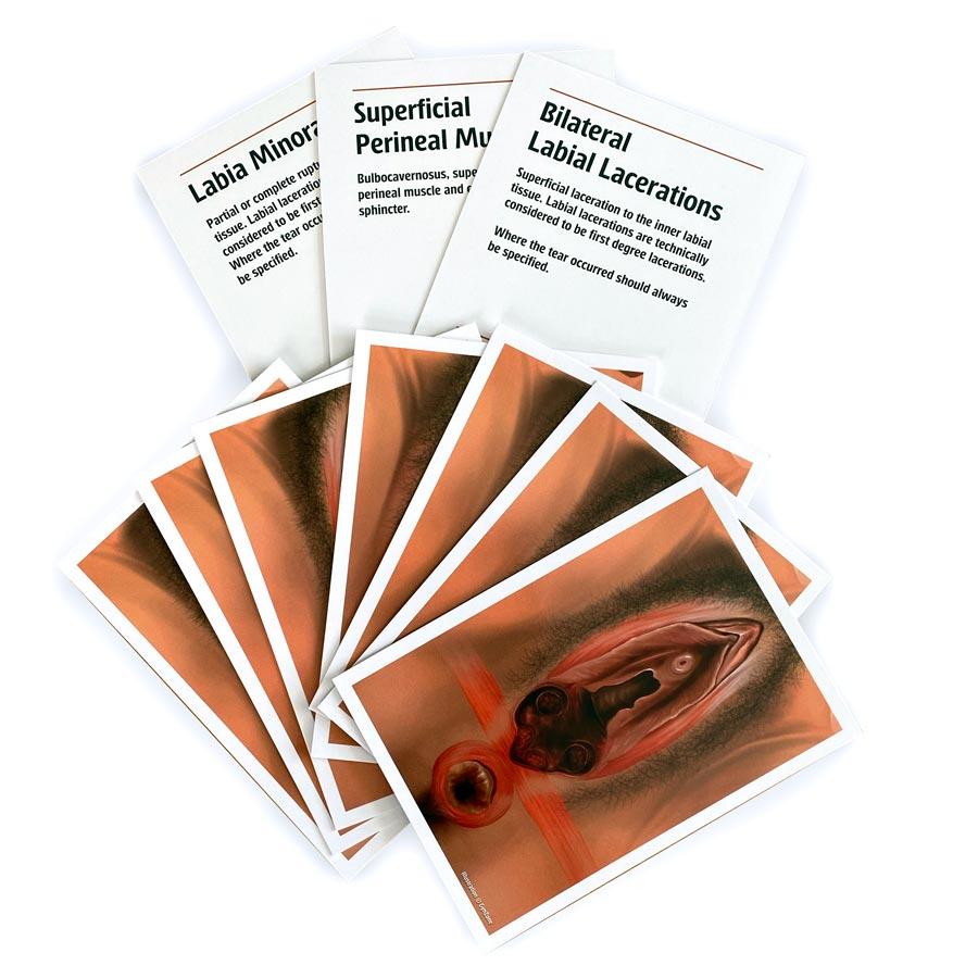 Laceration classification cards, set of 10 different cards. Box with 50 sets.